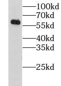 AGPAT7 Antibody - BSA Free