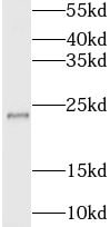 LOH12CR1 Antibody - BSA Free