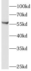 LMBR1L Antibody - BSA Free