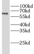 LIPC Antibody - BSA Free
