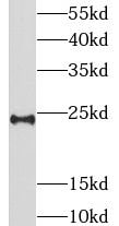 LIN7B Antibody - BSA Free