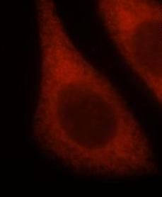 LHPP Antibody - BSA Free