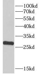 LHPP Antibody - BSA Free