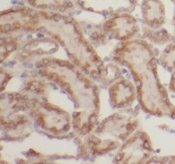 LHPP Antibody - BSA Free