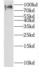 LEPREL2 Antibody - BSA Free