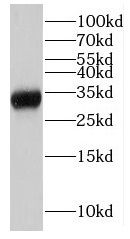 LDHAL6A Antibody - BSA Free