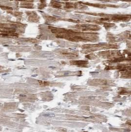 LATS2 Antibody - BSA Free