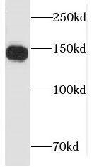 LARP1 Antibody - BSA Free