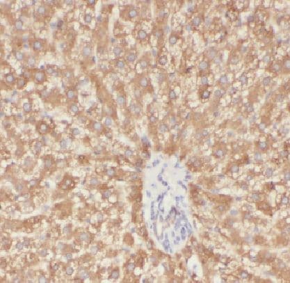 LAPTM4B Antibody - BSA Free