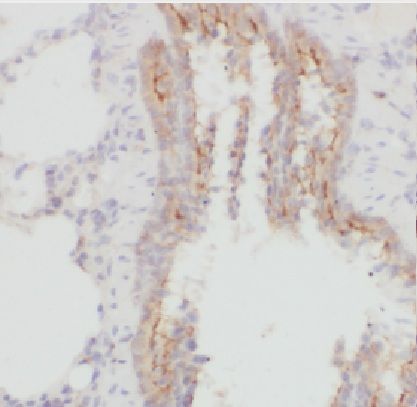 LANCL1 Antibody - BSA Free