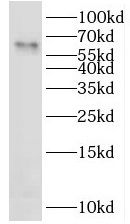 LAD1 Antibody - BSA Free