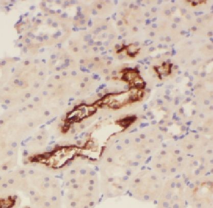 LAD1 Antibody - BSA Free