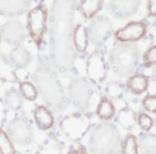 lactamase, beta 2 Antibody - BSA Free