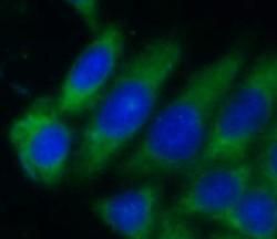 lactamase, beta 2 Antibody - BSA Free