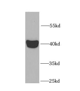 L2HGDH Antibody - BSA Free