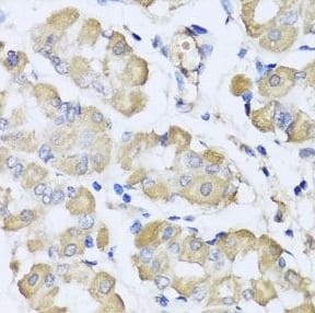 L2HGDH Antibody - BSA Free