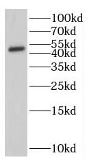 IFIT5 Antibody - BSA Free