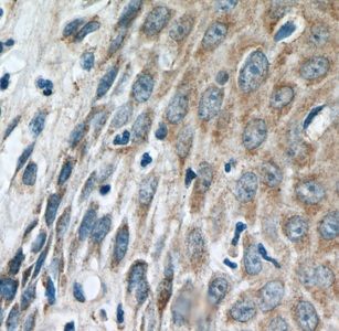 IFIT5 Antibody - BSA Free