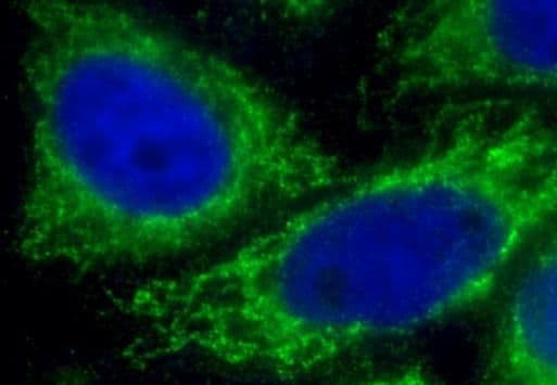 IFIT2 Antibody - BSA Free
