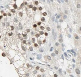 IFIT1B Antibody - BSA Free