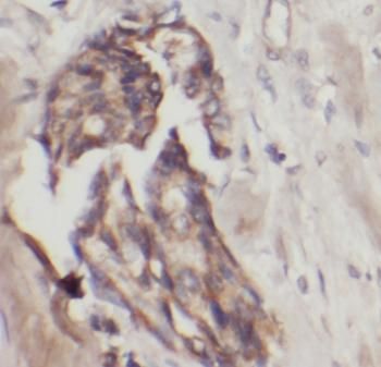 IFIT1 Antibody - BSA Free