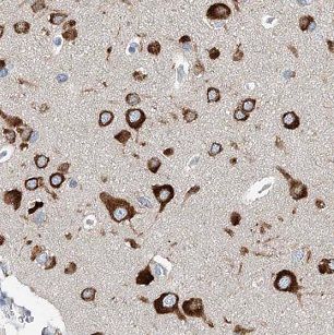 IFFO Antibody - BSA Free