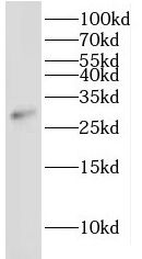 IDI2 Antibody - BSA Free