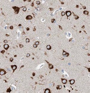 ALS2CR15 Antibody - BSA Free