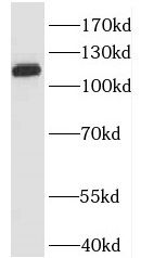 IARS2 Antibody - BSA Free