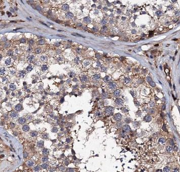 Hyaluronidase 4/HYAL4 Antibody - BSA Free