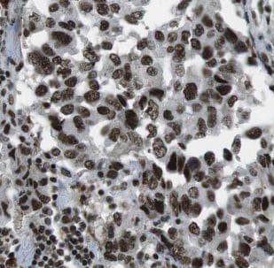 HYAL2 Antibody - BSA Free