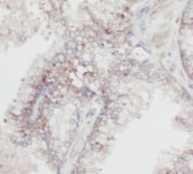 HSDL2 Antibody - BSA Free