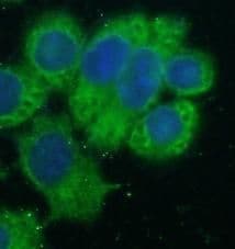HSDL2 Antibody - BSA Free