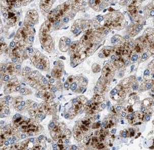 HSDL1 Antibody - BSA Free