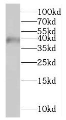 HSDL1 Antibody - BSA Free