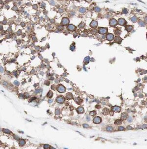 Beta Hydroxysteroid Dehydrogenase Antibody - BSA Free