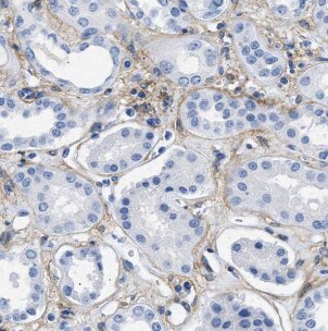 hydroxysteroid (17-beta) dehydrogenase 11 Antibody - BSA Free