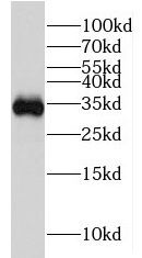 hydroxysteroid (17-beta) dehydrogenase 11 Antibody - BSA Free