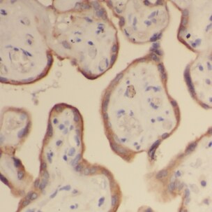 HRASLS5 Antibody - BSA Free
