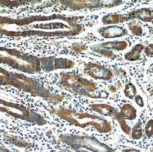 HPDL Antibody - BSA Free
