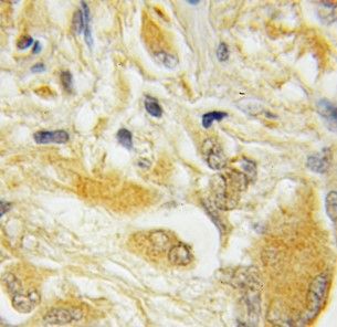 Hippocalcin like 4 Antibody - BSA Free