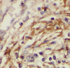 PSMC3IP Antibody - BSA Free
