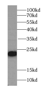 PSMC3IP Antibody - BSA Free