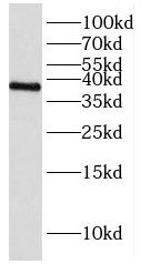 HNRPH3 Antibody - BSA Free