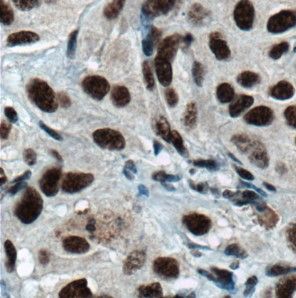 hnRNP H Antibody - BSA Free