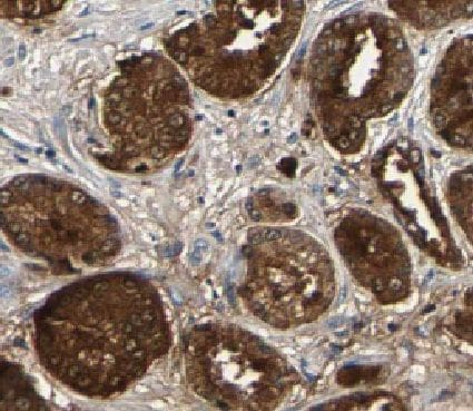 HMGN2 Antibody - BSA Free