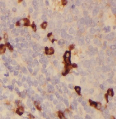 HLA DRB5 Antibody - BSA Free