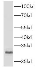 HLA DRB5 Antibody - BSA Free