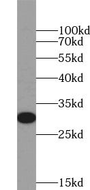 HLA DQB2 Antibody - BSA Free