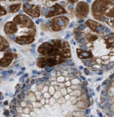 HIVEP1 Antibody - BSA Free
